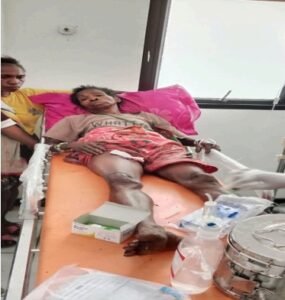 Tiga Warga Tertembak saat Mencari Pangan